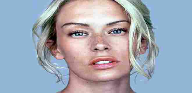 Güneş lekesinden nasıl